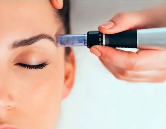 Dermapen: tecnología precisa para una piel saludable y cuidada con confianza